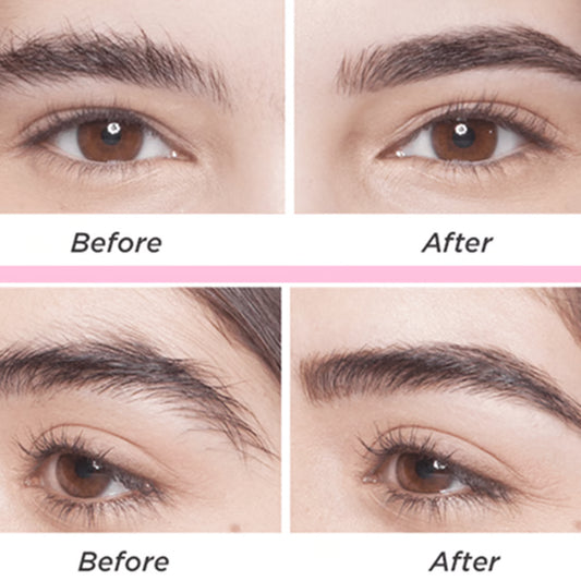 Eyebrow & Face Epilator
