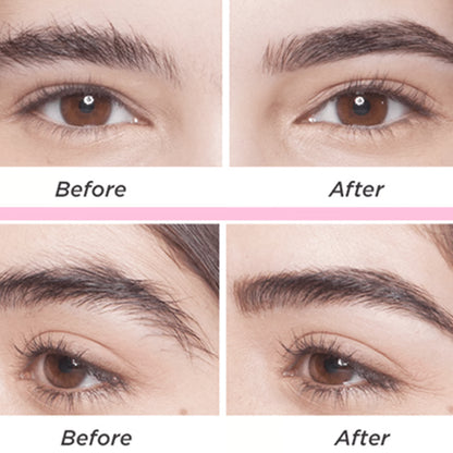 Eyebrow & Face Epilator