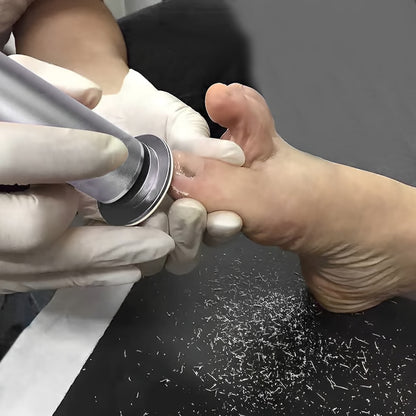 Professional Electric Callus Remover – Perfect Gift for Silky Smooth Feet